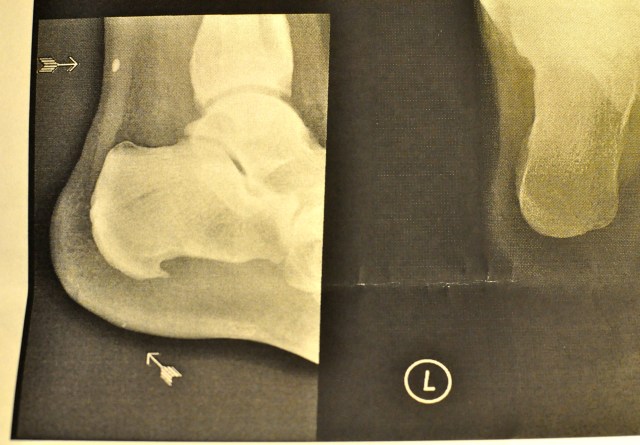 The Achilles Heel of the Americas was the lack of cultural confidence typical of new settlers.