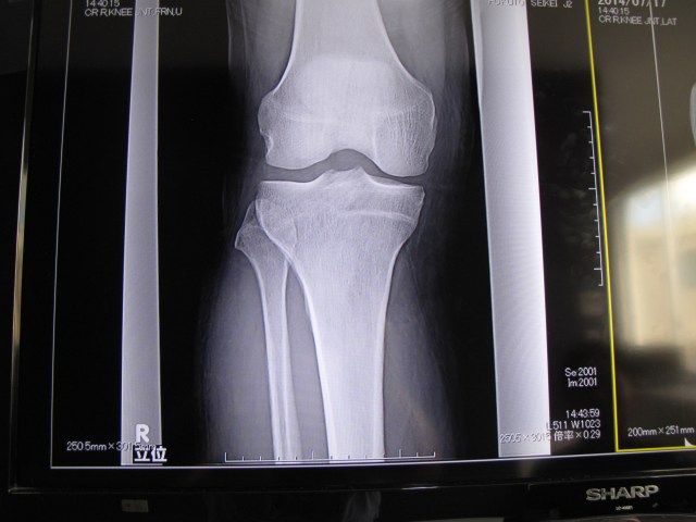 The doctor, the learned Shima sensei, said I had a beautiful knee for a man of my age. I blushed.