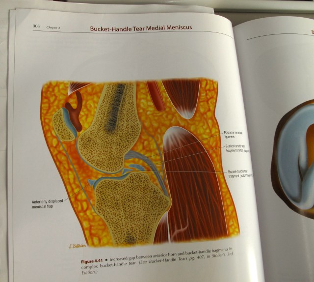 There's a hole in my bucket.