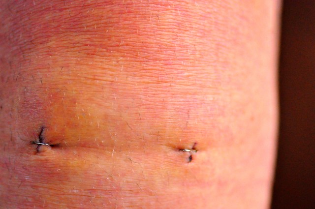 Knees up Mother Brown