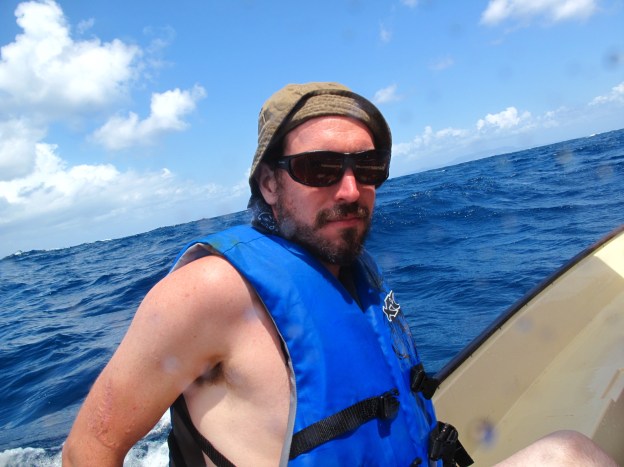 James mulls over our options